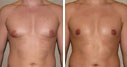 Before & After Photos